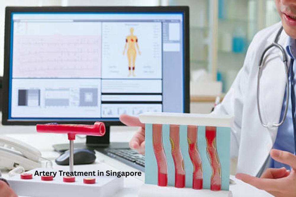 artery treatment in Singapore