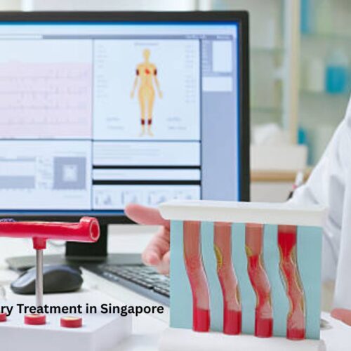 Artery Treatment in Singapore at RafflesMedical for Cambodia Patients