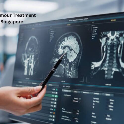 Brain Tumour Treatment in Singapore at RafflesMedical for Cambodia Patients