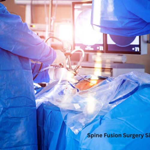 Spine Fusion Surgery Singapore: A Complete Guide to Procedure, Benefits, and Recovery
